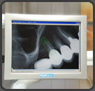 Digitale Computer Röntgenbilder